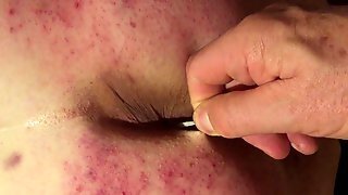 Anal Insertions