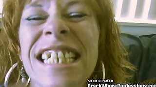 Donkey Teeth Red Head Mom Crack Slut