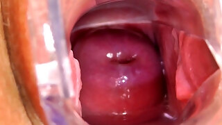 Jennifer Amton Comes To Her Gyno Doctor